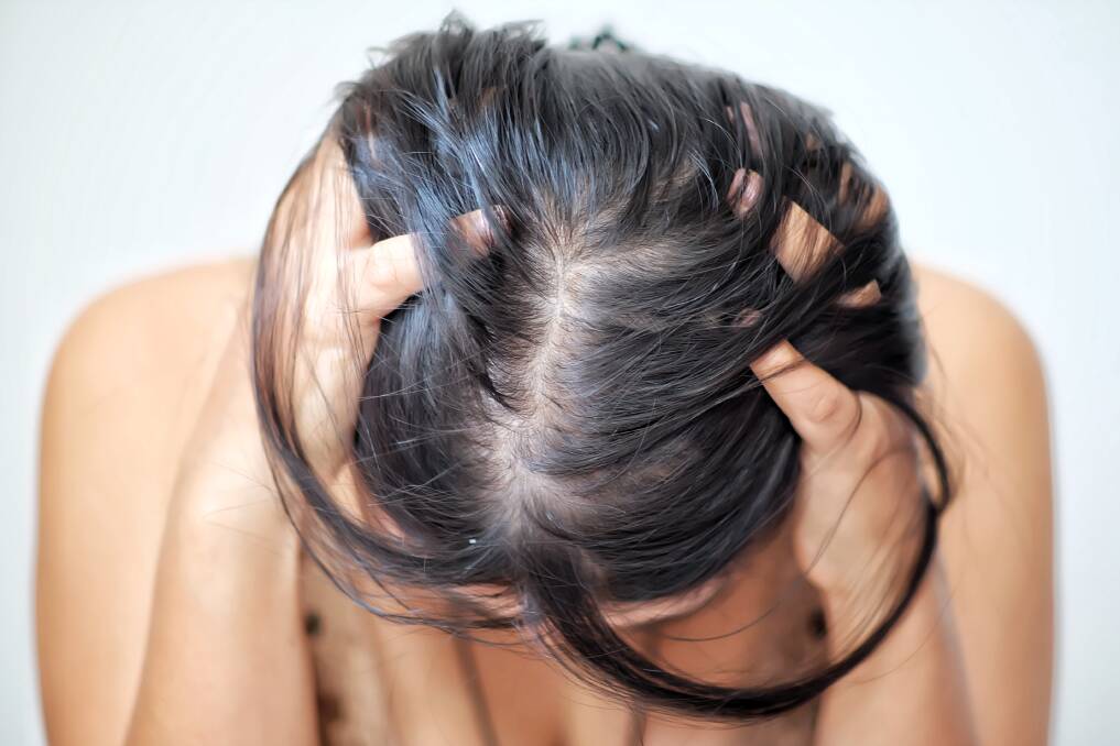 Scalp and Thin Hair Hair Removal Stock Image  Image of gray hand  162712061